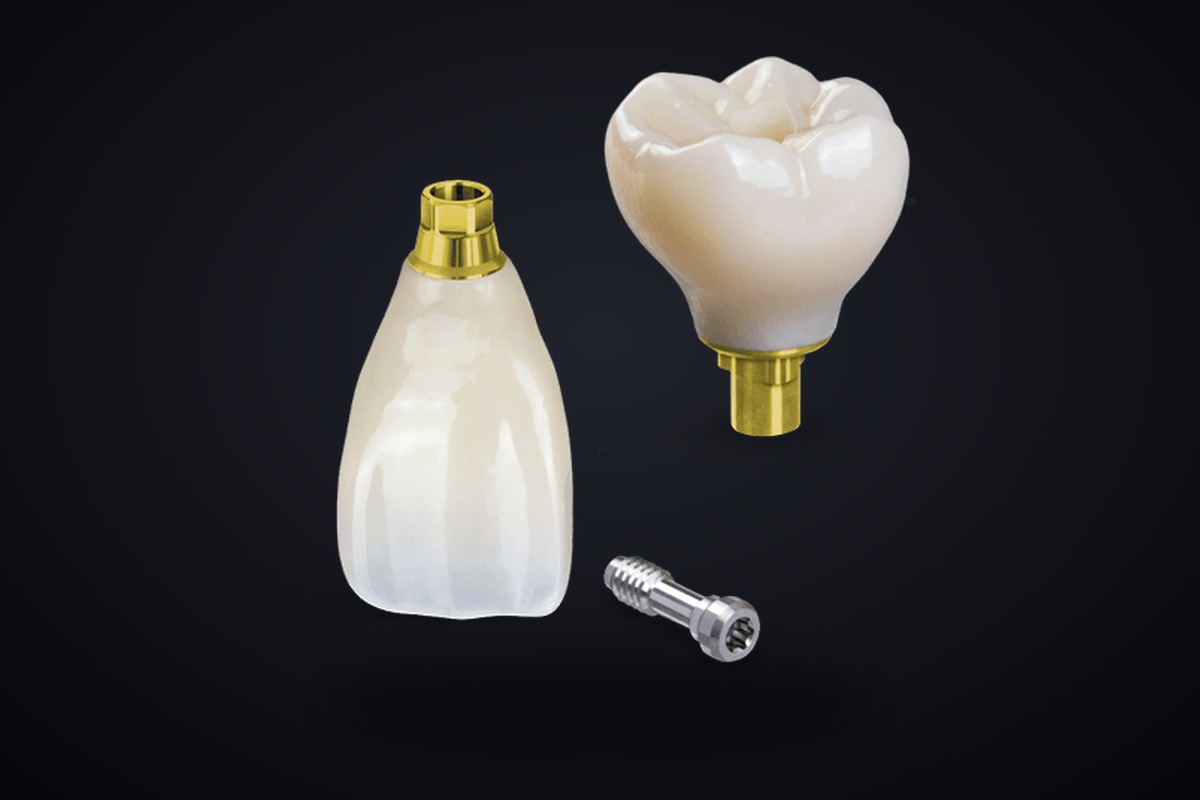Implant crown restoration on custom abutment