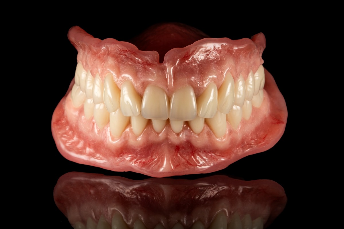 Two-appointment digital denture
