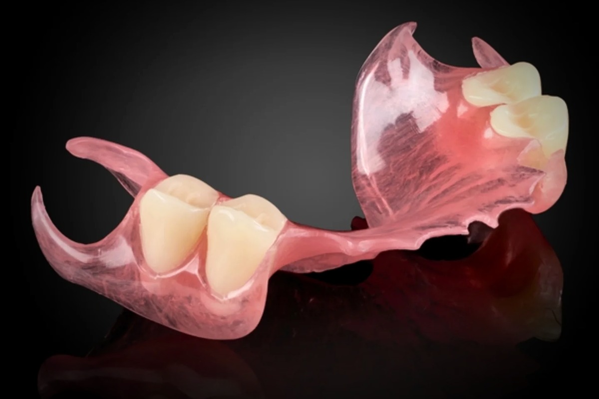 Digital removable partial denture